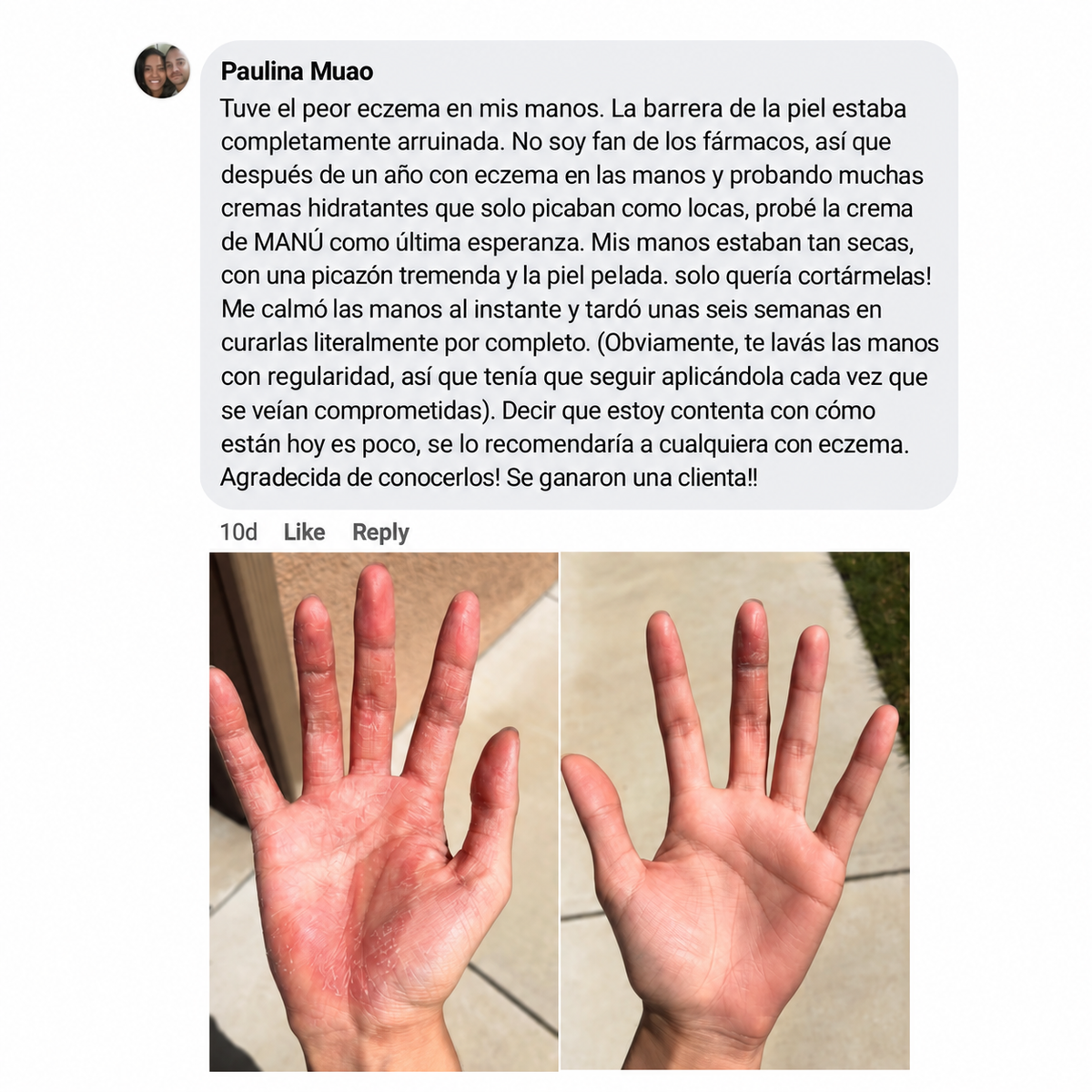 Crema Natural MANÚ® para Eczema y Psoriasis – 100 g